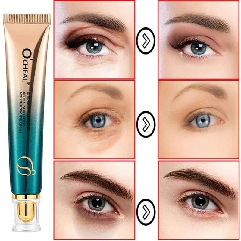 Anti Wrinkle Eye Cream Retinol Fade Fine Lines Anti-dark Circles Remove  Eye Bags Anti-aging Firming Eye Serum Eye Care Cream