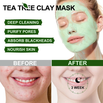 Acne Treatment Facial Mask